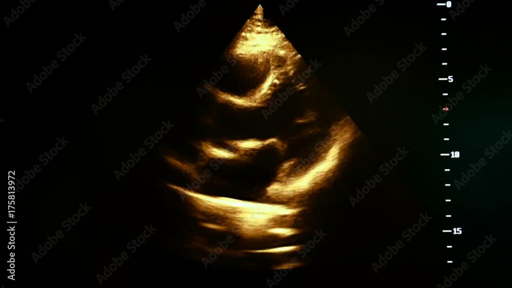 Colourful footage of pregnancy ultrasound monitor Stock Video | Adobe Stock
