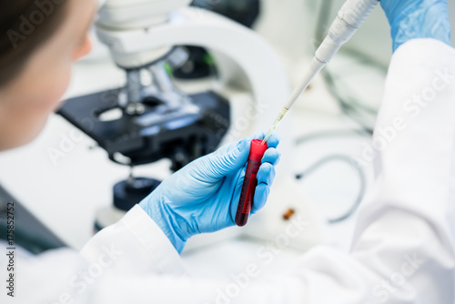 Arzt oder Laborant füllt Lösung in Bluttest im Labor photo