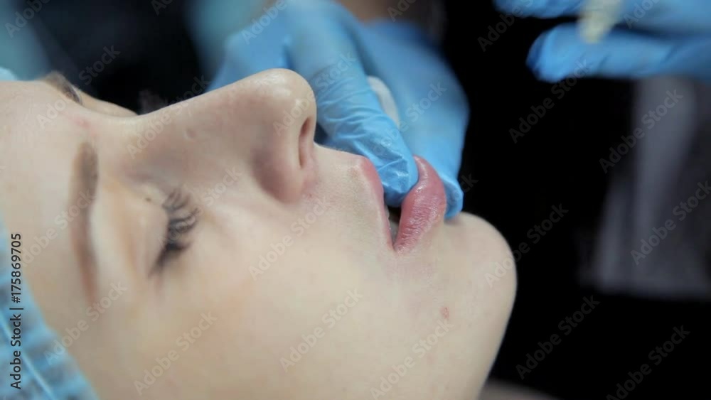 The doctor-cosmetologist introduces Botox into the girl's lips to enlarge them. Lip augmentation in the clinic. Close-up The doctor-cosmetologist introduces Botox into the girl's lips to enlarge them. Lip augmentation in the clinic. Close-up
