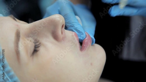 The doctor-cosmetologist introduces Botox into the girl's lips to enlarge them. Lip augmentation in the clinic. Close-up photo