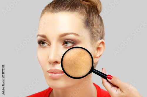Canvas Print Dark spots, freckles,hyperpigmentation(melasma or chloasma)