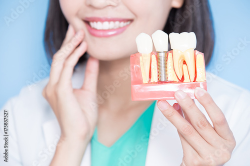 woman dentist take implant tooth photo