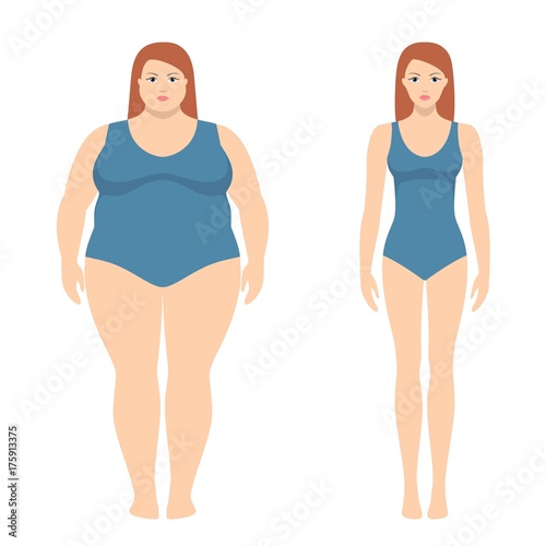 Vector illustration of fat and slim woman in flat style. Weight loss concept, before and after. Obese and normal female body.