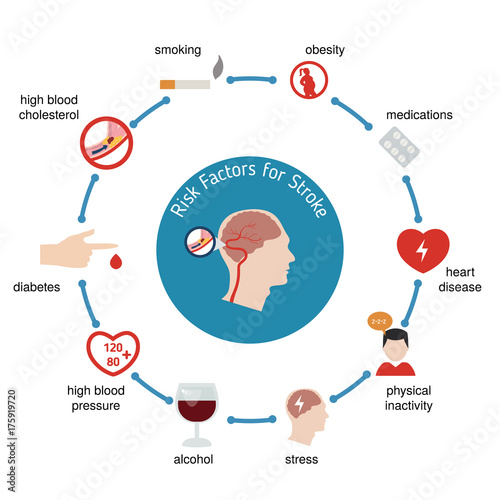 Infographics for stroke
