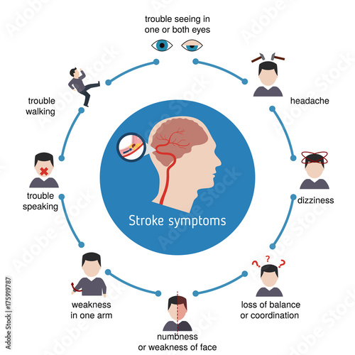 Infographics for stroke