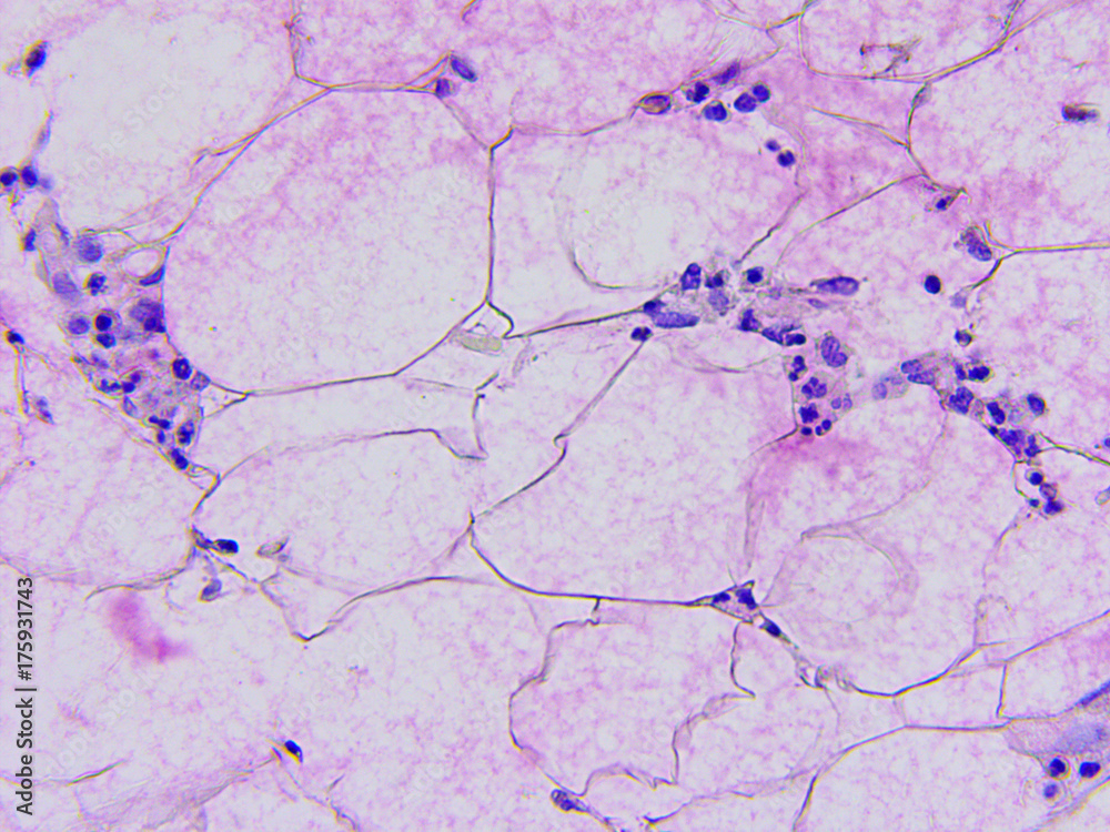 Microscopic photography of mucous membrane of the appendix, color test for enzymes, positive mucus