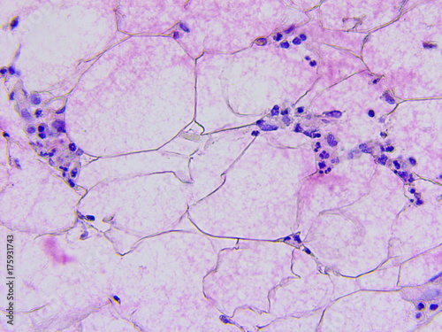 Microscopic photography of mucous membrane of the appendix, color test for enzymes, positive mucus photo
