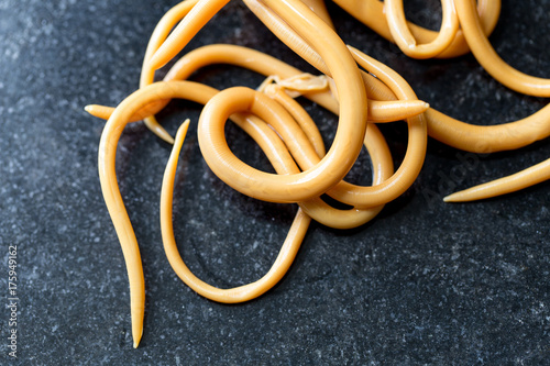 Ascariasis is a disease caused by the parasitic roundworm Ascaris lumbricoides for education in laboratories.