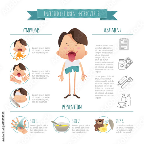 Infected children. Enterovirus. Hand-foot-mouth disease Infographics. Symptoms, prevention and treatment. Cartoon poster detail health concept photo