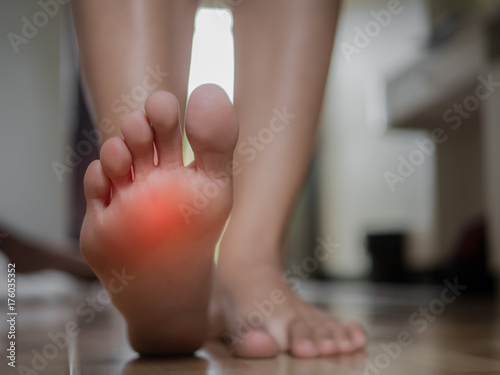 Closeup female foot pain, Health care concept. © Siam