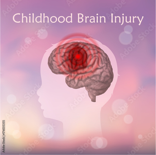 Brain injury in infants, childhood. Vector medical illustration. Kid, baby. Blurred pink background, silhouette of child head, anatomy image of damaged human brain.