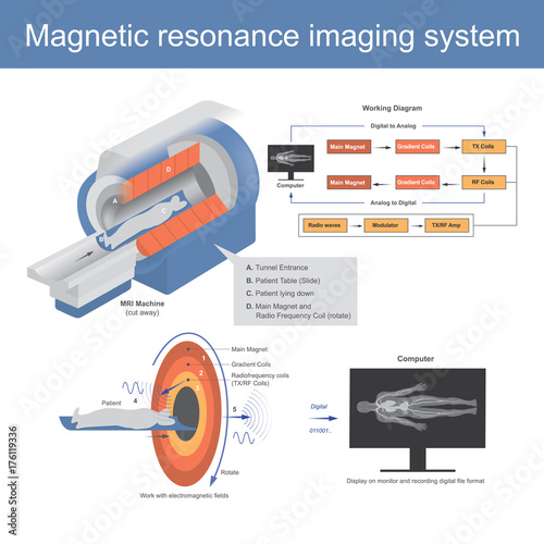 The Mechanical technique used in radio wave to form pictures of the anatomy and the magnetic physiological processes of the body in both health and disease. Illustration graphic.