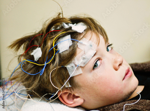 Close-Up portrait of a Boy getting an EEG procedure for epilepsy photo