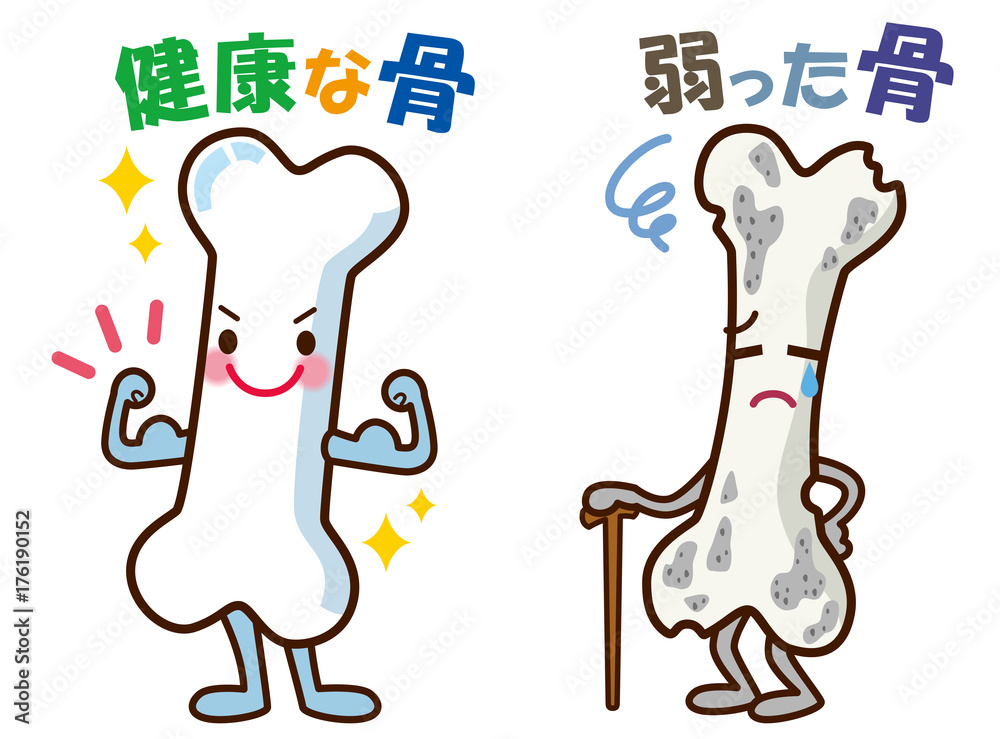 Φωτογραφία 健康な骨　弱った骨　キャラクター