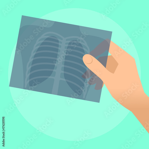 Human hand holds x-ray image of lung. Flat illustration of doctor's hand holding radiograph. Medicine, medical exam and diagnosis concept. Vector design elements for web, internet, presentation