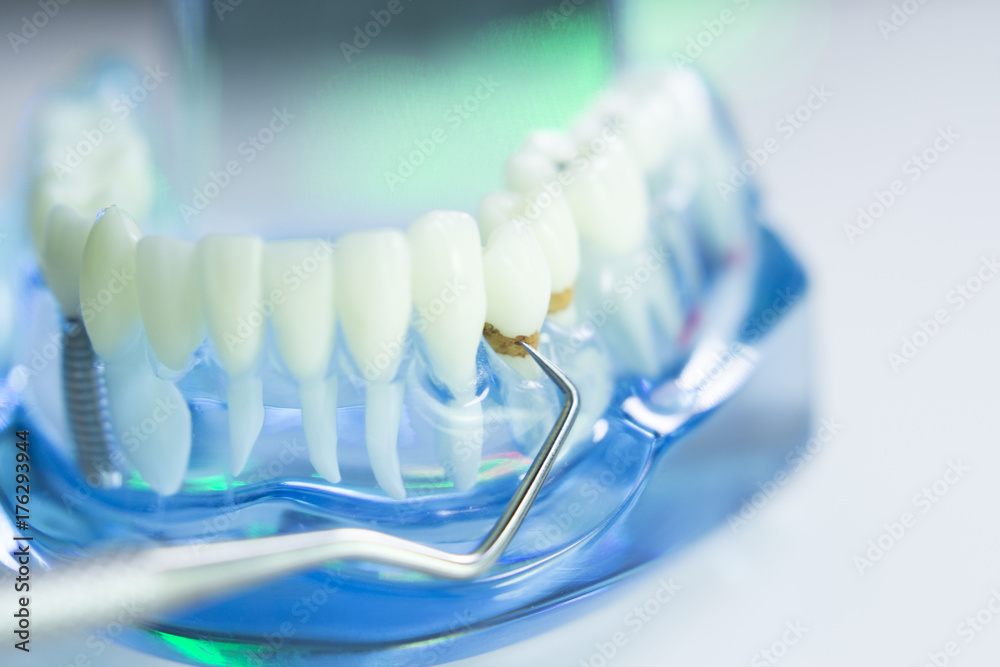 Dental teeth dentist model Dental teeth dentist model