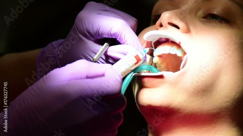 Setting cheek retractor and dental suction into the girl's mouth