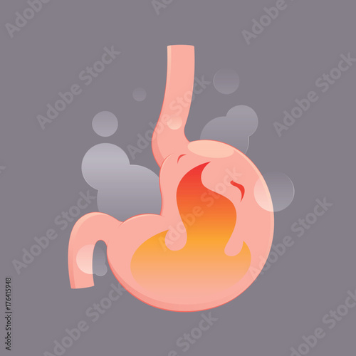 Illustration from acid reflux or heartburn, Cartoon vector, Concept with internal health