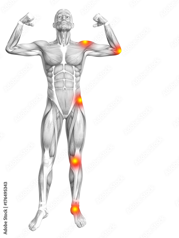 Conceptual human muscle anatomy with red and yellow hot spot inflammation or articular joint pain for health care therapy or sport concepts. 3D illustration man arthritis or bone osteoporosis disease Conceptual human muscle anatomy with red and yellow hot spot inflammation or articular joint pain for health care therapy or sport concepts. 3D illustration man arthritis or bone osteoporosis disease
