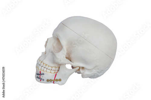 Skull made from resin. Broken jaw was fixed by seizing Plate screw. Left View On white Background.