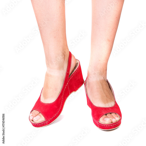 legs of a girl orthopedic shoes on white isolated background