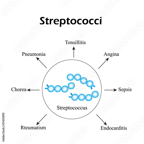 Streptococci. Streptococcal diseases. Infographics. Vector illustration