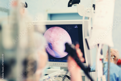 endoscopy examination procedure with endoscope equipment in surgical room endoscopic exam with latest technology