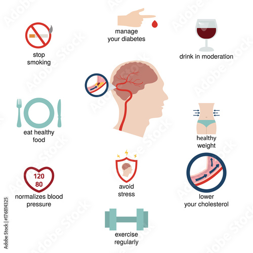 Infographics for stroke