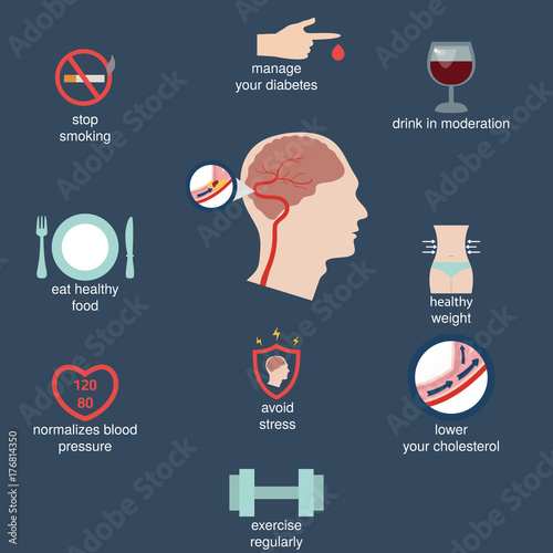 Infographics for stroke