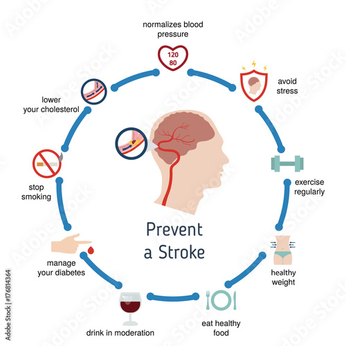 Infographics for stroke