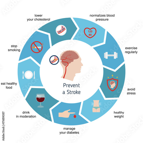 Infographics for stroke