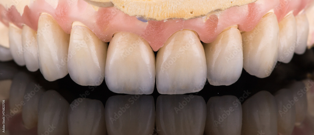dental crown dental crown