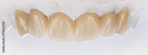 Fényképezés dental crown