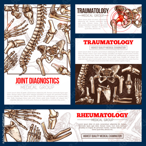 Medical banner template set of bone, joint x-ray