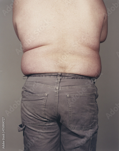 View from behind of overweight man wearing no shirt