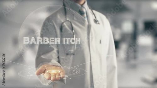 Doctor holding in hand Barber Itch photo