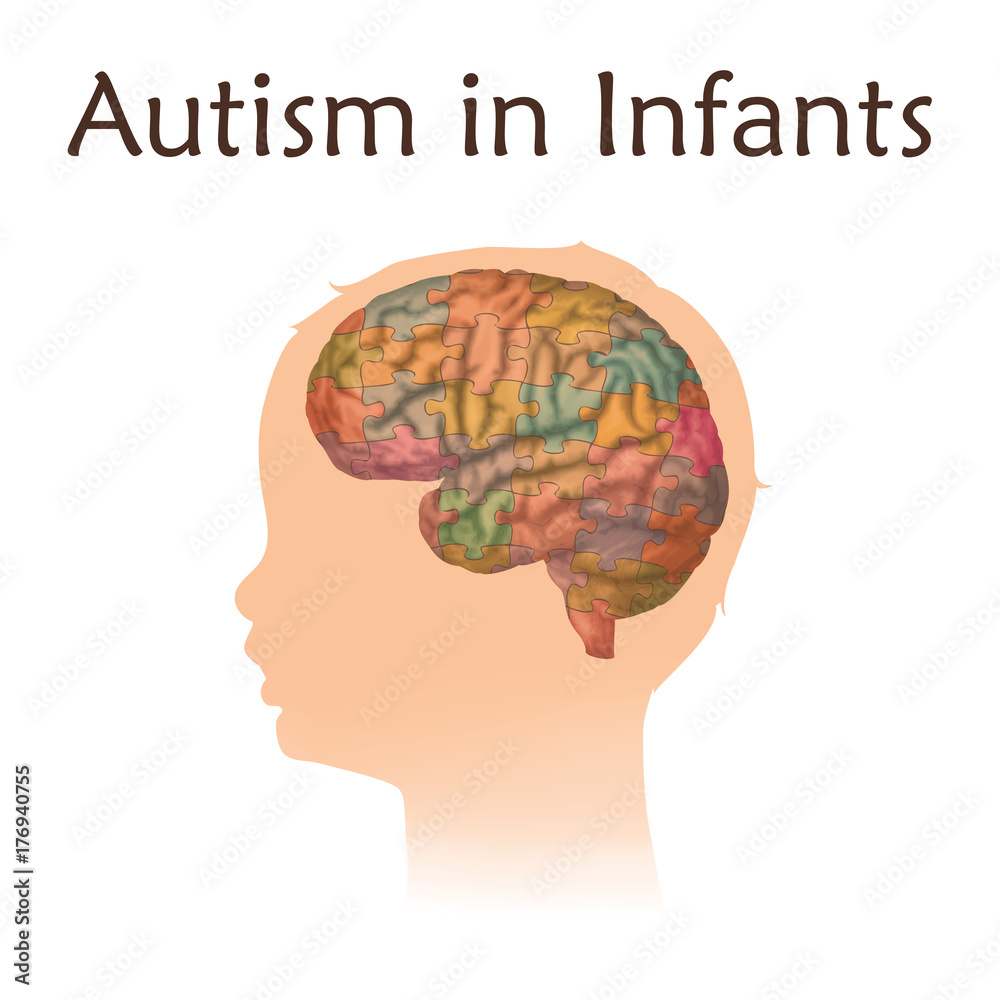 autism brain diagram