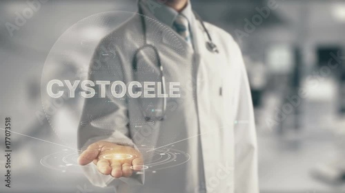 Doctor holding in hand Cystocele