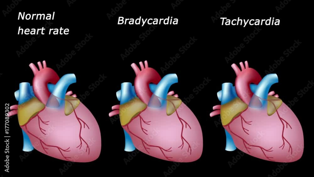Sinus bradycardia and tachycardia: normal and pathological heart rates, loopable animation. 