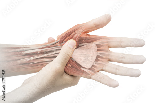 hand muscle pain photo