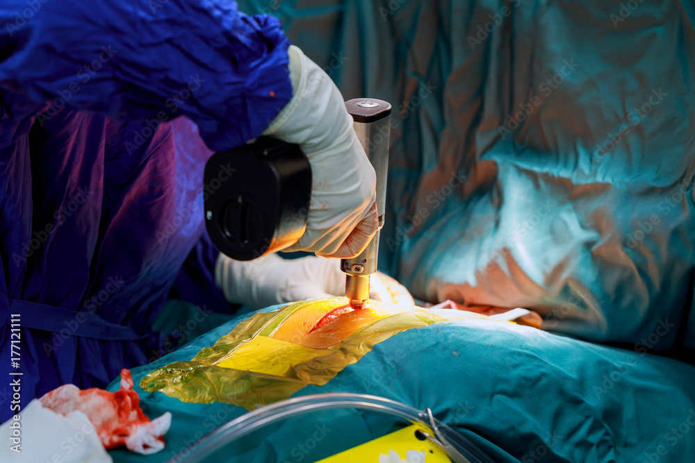Cutting the chest during an operation on the heart operation room Cutting the chest during an operation on the heart operation room