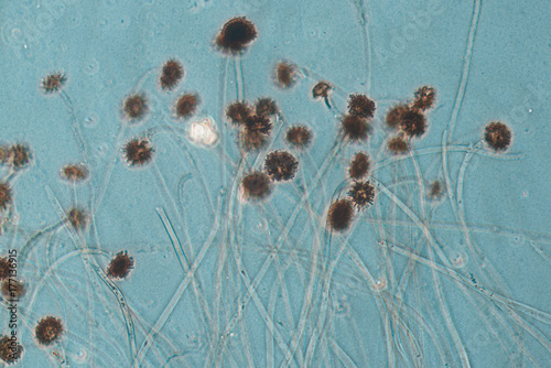 Aspergillus fungus photo