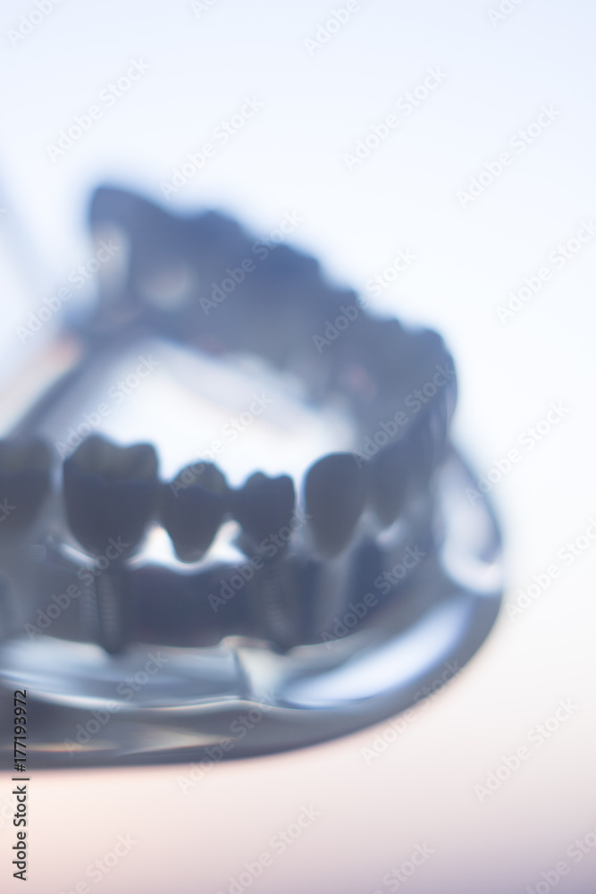 Dental teeth mouth model Dental teeth mouth model