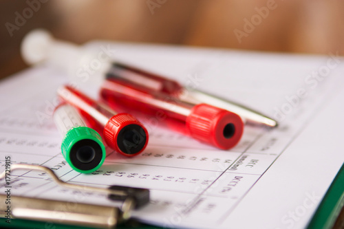 Selective focus of Hematology blood analysis report with lavender color blood sample collection tubes.