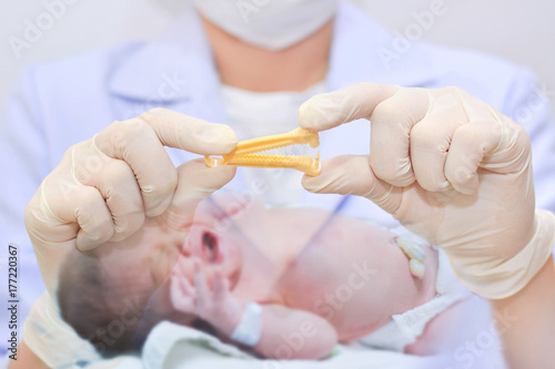 Double exposure of close up of doctor holding yellow umbilical cord clamp used to clamp off the umbilical cord after a baby's birth.