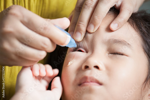 Mother dripping eye medicine in the child girl eyes