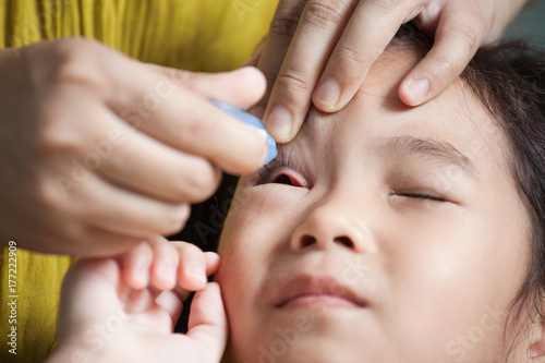 Mother dripping eye medicine in the child girl eyes