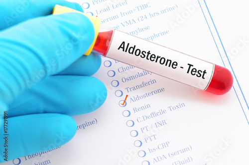 Blood sample with requisition form for aldosterone hormone test photo