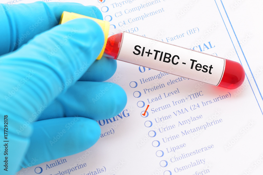 Blood sample with requisition form for serum iron and TIBC test Stock