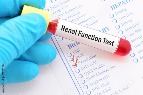 Fotografie Blood sample with requisition form for renal function test